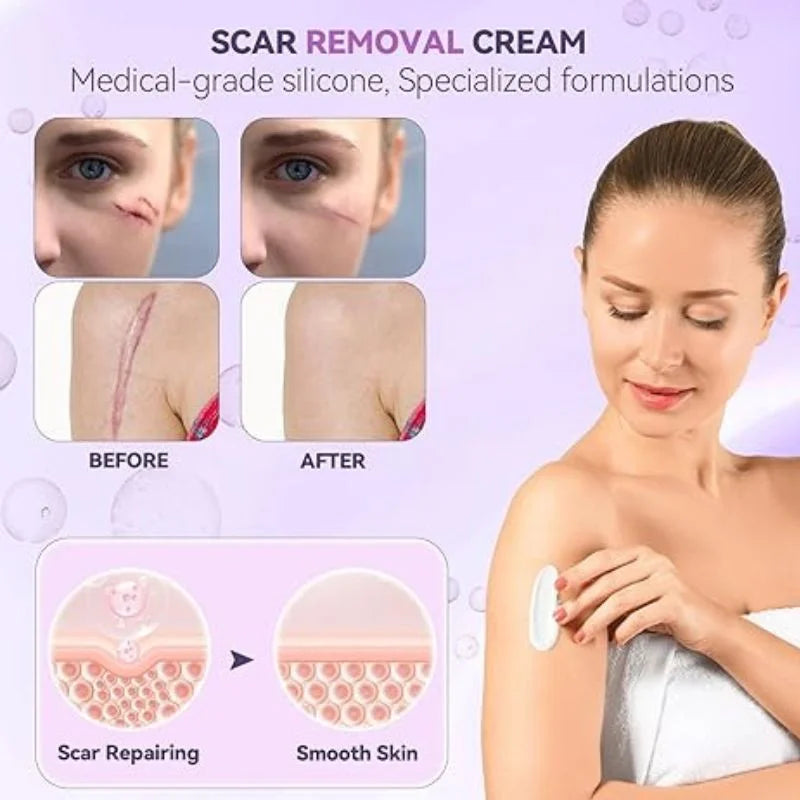 TIMILK Scarvanisher Scar Gel 30g | Advanced Scar & Stretch Marks Removal Cream | Fast-Absorbing Skin Repair Gel