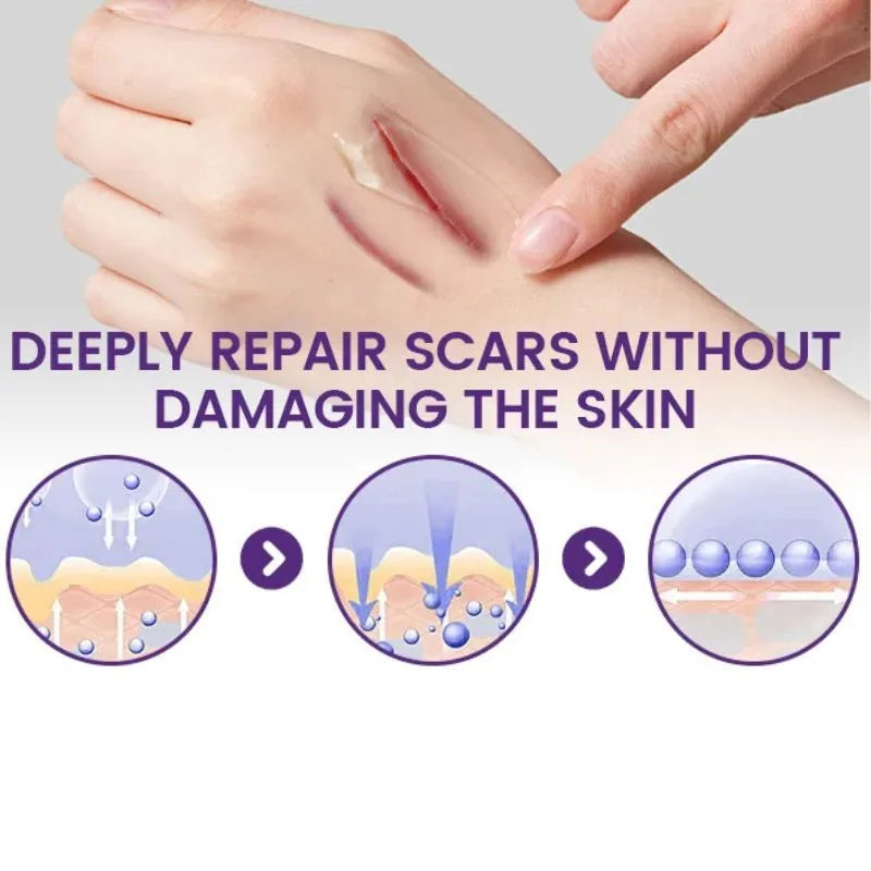 TIMILK Scarvanisher Scar Gel 30g | Advanced Scar & Stretch Marks Removal Cream | Fast-Absorbing Skin Repair Gel
