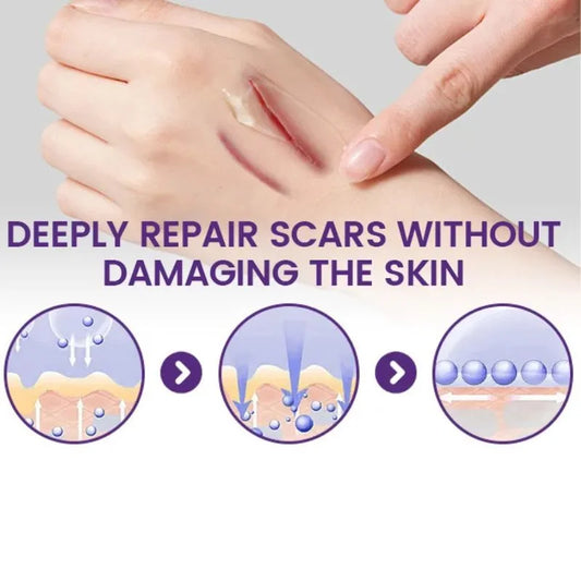 TIMILK Scarvanisher Scar Gel 30g | Advanced Scar & Stretch Marks Removal Cream | Fast-Absorbing Skin Repair Gel