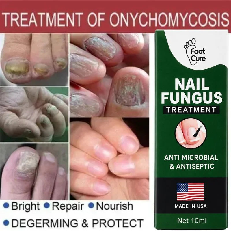 Fast Nail Fungus Treatment Serum | Nail Repair Essence for Fingernails & Toenails | Natural Nail Care Formula