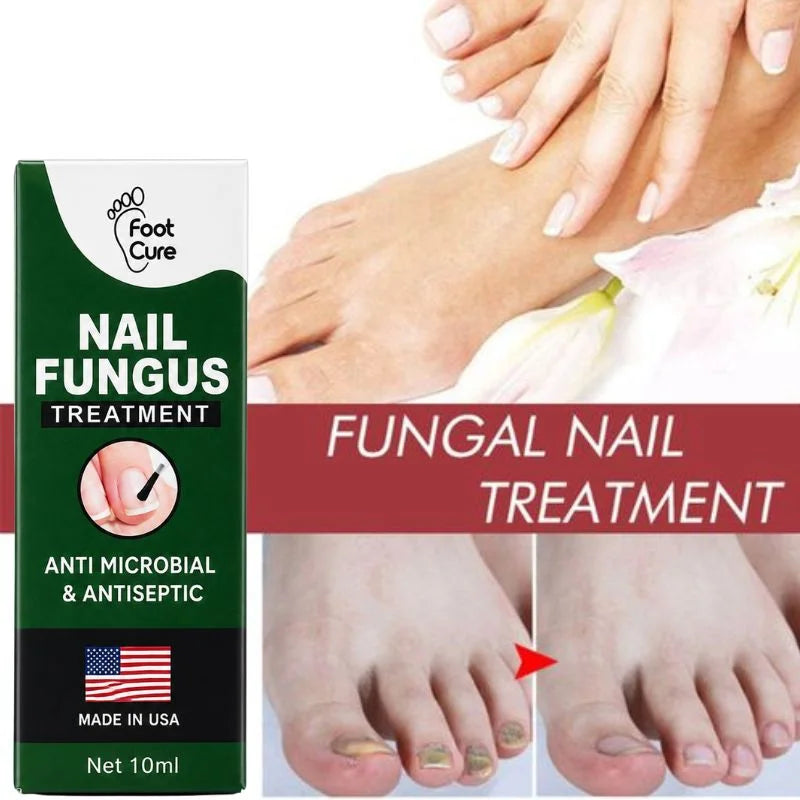 Fast Nail Fungus Treatment Serum | Nail Repair Essence for Fingernails & Toenails | Natural Nail Care Formula