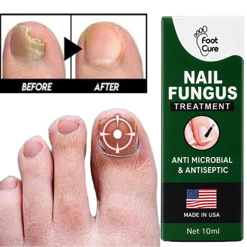 Fast Nail Fungus Treatment Serum | Nail Repair Essence for Fingernails & Toenails | Natural Nail Care Formula