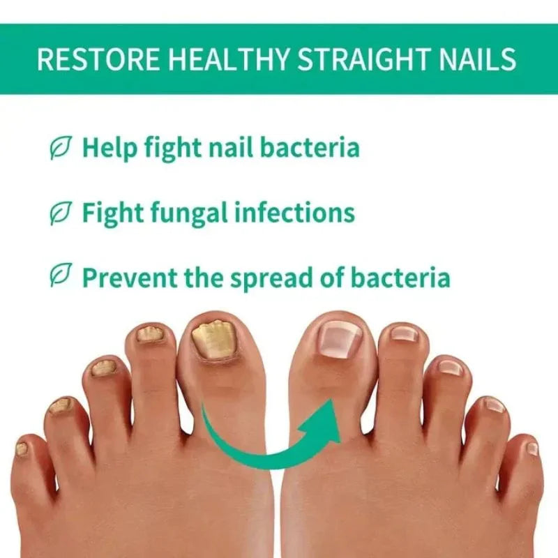 Fast Nail Fungus Treatment Serum | Nail Repair Essence for Fingernails & Toenails | Natural Nail Care Formula