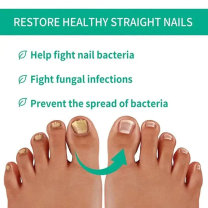 Fast Nail Fungus Treatment Serum | Nail Repair Essence for Fingernails & Toenails | Natural Nail Care Formula