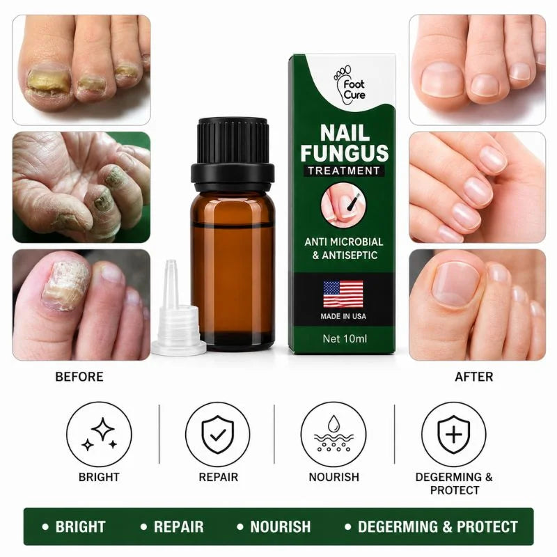 Fast Nail Fungus Treatment Serum | Nail Repair Essence for Fingernails & Toenails | Natural Nail Care Formula