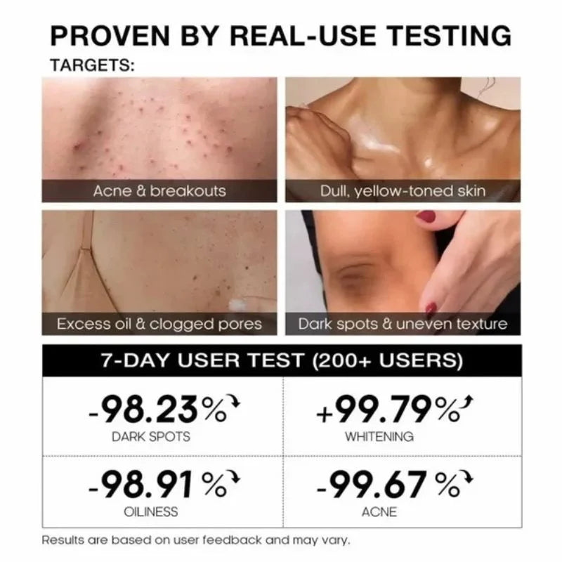 TeaShell Niacinamide Skin Brightening Soap | Face & Body Brightening Bar with Niacinamide, Alpha Arbutin & Tranexamic Acid | Deep Cleansing Formula | For Men & Women | 100g