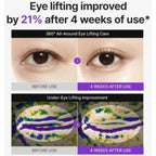 Centellian24 360° Shot PDRN Lifting Eye Cream | Anti-Aging Eye Cream for Wrinkles, Puffiness & Dark Circles | Firming & Hydrating Formula | 30ml