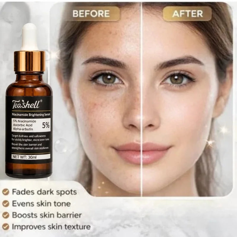 Teashell 5% Niacinamide Brightening Serum | Alpha Arbutin & Ascorbyl Acid | Dark Spot & Acne Mark Care | For All Skin Types | 30ml