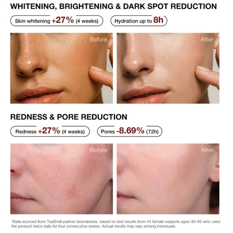 Teashell 5% Niacinamide Brightening Serum | Alpha Arbutin & Ascorbyl Acid | Dark Spot & Acne Mark Care | For All Skin Types | 30ml